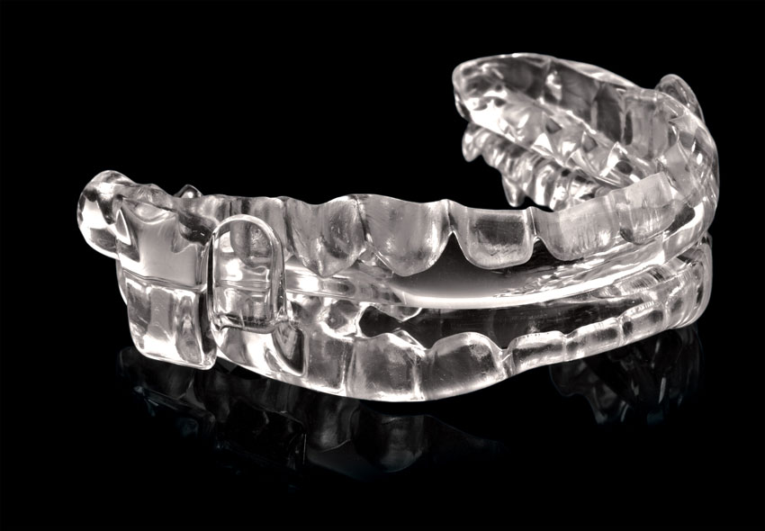 sleep apnea oral appliance
