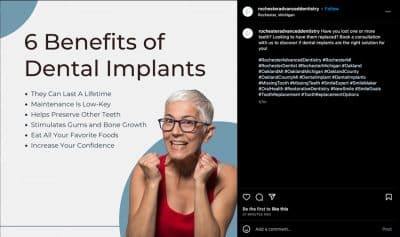 example of aligned marketing on social media for a dental practice looking to get more new dental implant patients